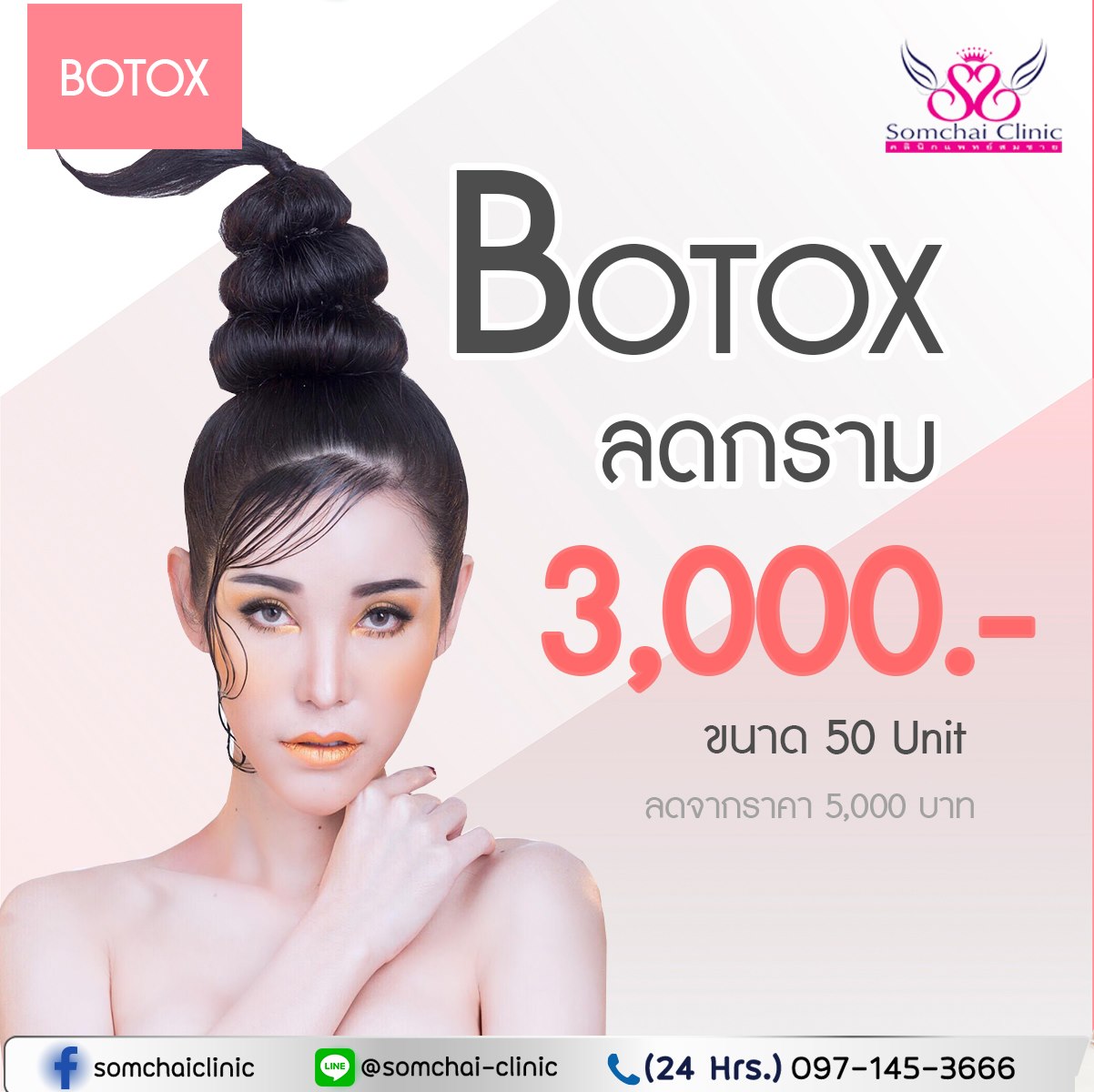 Botoxลดกราม-SomchaiClinic-09122021