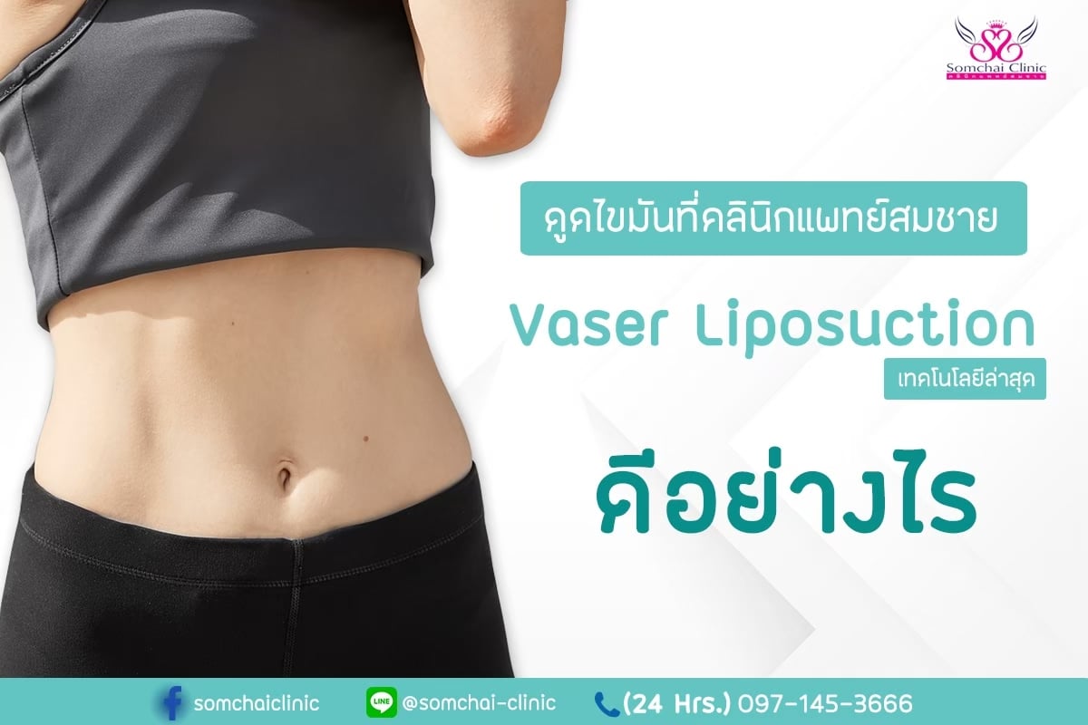 Vaser1-SomchaiClinic
