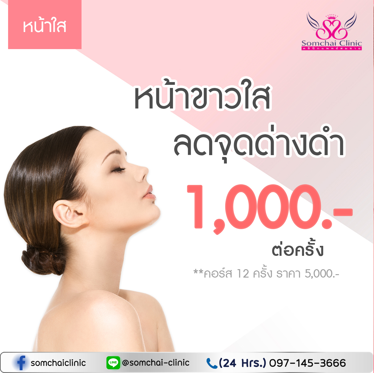 หน้าใส-SomchaiClinic-09122021