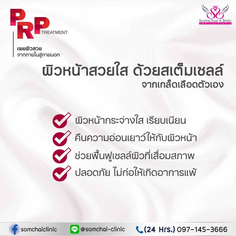 Pro-PRPTreatment-2-SomchaiClinic