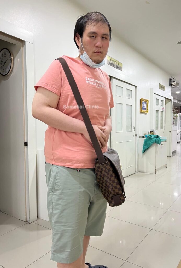 รีวิว การผ่าตัดส่องกล้องลดขนาดกระเพาะ2-SomchaiClinic